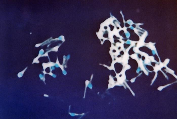 clostridium tetani pod mikroskopym